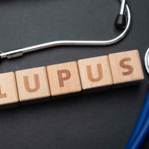 4 things to avoid when dealing with lupus