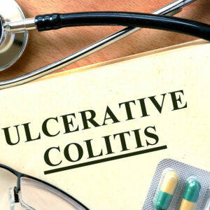 4 signs that indicate ulcerative colitis development