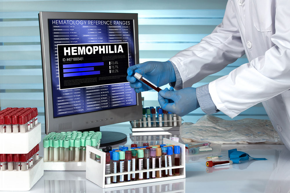 5 ways to live healthy with hemophilia